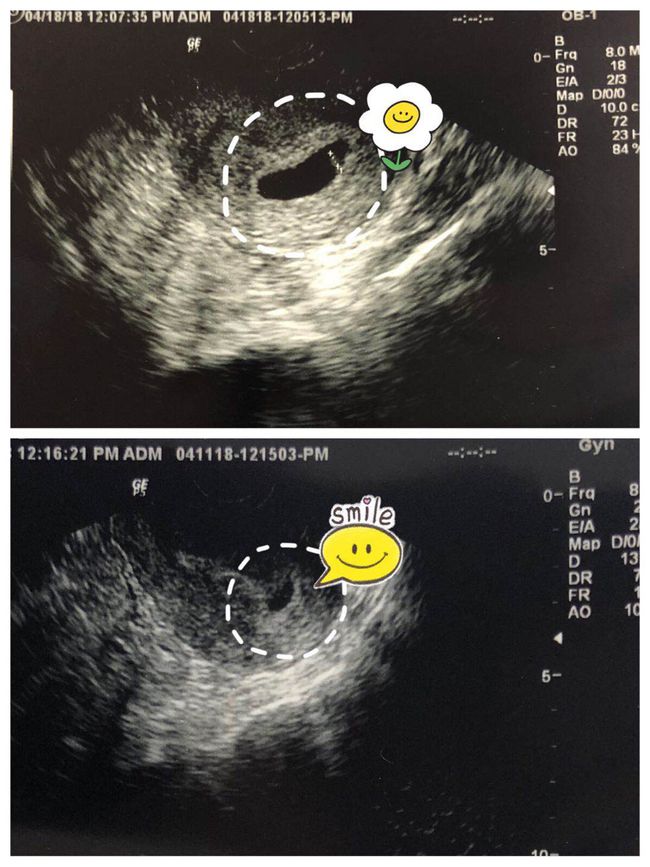 上海天使助孕机构微信群